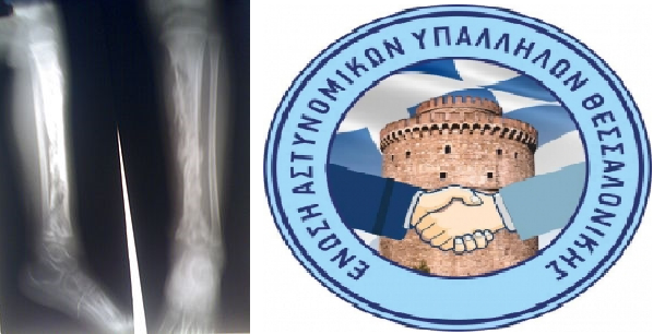 ΕΑΥΘ: «Ο «μικρός πρίγκιπας» χρειάζεται βοήθεια»!