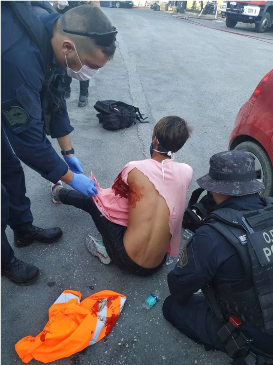Μόρια: Αφγανός δέχθηκε επίθεση με μαχαίρι από ομοεθνείς του- Αστυνομικοί του προσέφεραν τις πρώτες Βοήθειες