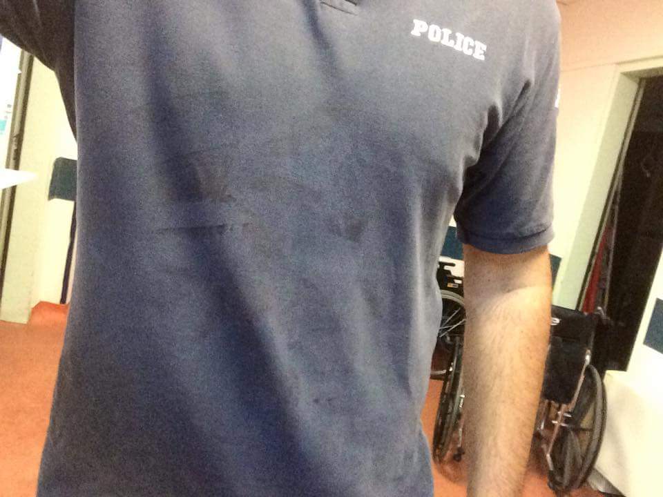 Λεσβος: Λαθρομετανάστης απειλησε με μαχαίρι Αστυνομικούς, αυτοτραυματίσθηκε και.. αφέθηκε ελεύθερος